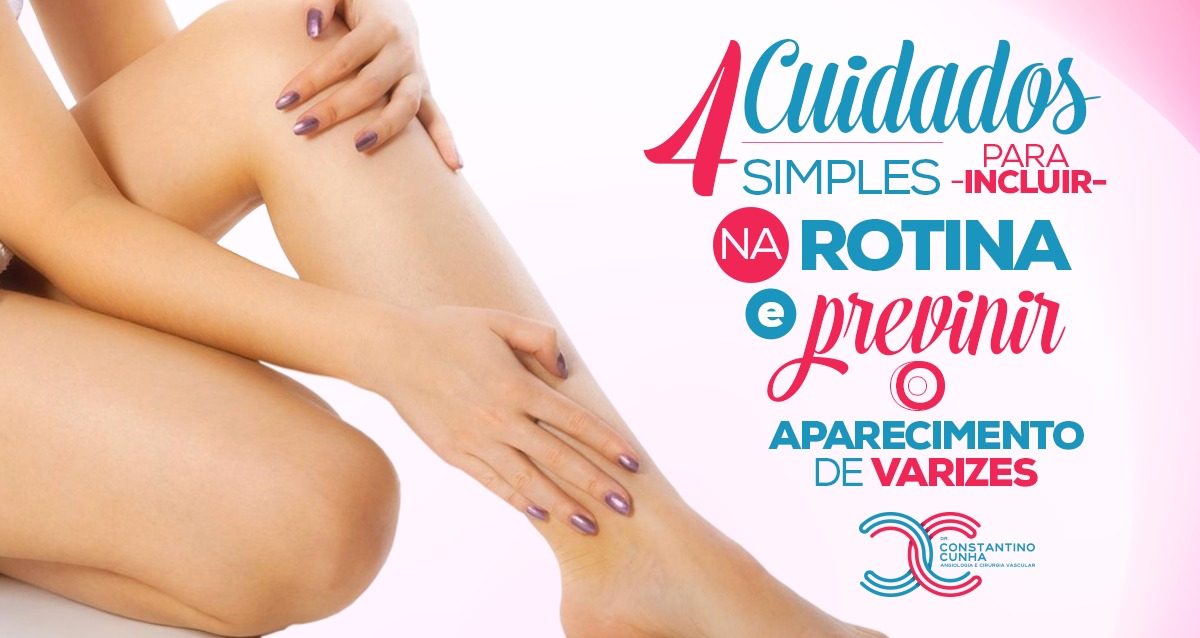 4 cuidados simples para incluir na rotina e prevenir o aparecimento de varizes