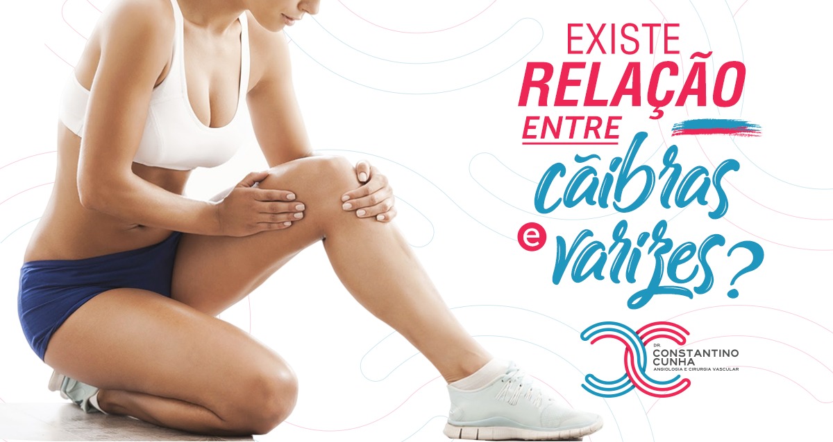 Existe relação entre cãibras e varizes?