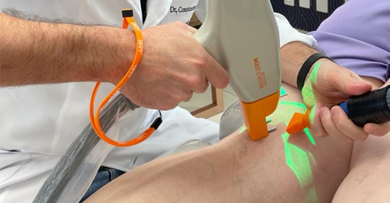 TRATAMENTO A LASER